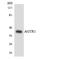 Angiotensin II type-1 receptor antibody, LS-C200104, Lifespan Biosciences, Western Blot image 