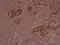 Mitogen-Activated Protein Kinase Kinase 2 antibody, A00996T394, Boster Biological Technology, Immunohistochemistry frozen image 