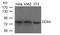 DEAD-Box Helicase 4 antibody, TA347845, Origene, Western Blot image 