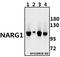 N(Alpha)-Acetyltransferase 15, NatA Auxiliary Subunit antibody, A05636, Boster Biological Technology, Western Blot image 