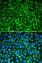 NIMA Related Kinase 2 antibody, 19-609, ProSci, Immunofluorescence image 