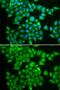 Phosphodiesterase 1B antibody, GTX54568, GeneTex, Immunofluorescence image 