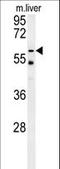 Peroxisomal leader peptide-processing protease antibody, LS-C160357, Lifespan Biosciences, Western Blot image 