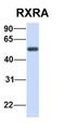 Cyclin Dependent Kinase 1 antibody, orb129553, Biorbyt, Western Blot image 