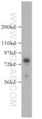 Radixin antibody, 13790-1-AP, Proteintech Group, Western Blot image 