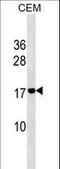 AM2 antibody, LS-C161011, Lifespan Biosciences, Western Blot image 