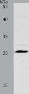 N-Ribosyldihydronicotinamide:Quinone Reductase 2 antibody, TA323536, Origene, Western Blot image 