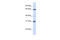 Guanylate Binding Protein 2 antibody, ARP54714_P050, Aviva Systems Biology, Western Blot image 