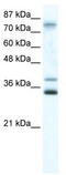 Zinc Finger Protein 570 antibody, TA341456, Origene, Western Blot image 