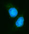 Eukaryotic Translation Initiation Factor 4A1 antibody, M03922-2, Boster Biological Technology, Immunofluorescence image 