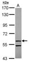 2'-5'-Oligoadenylate Synthetase Like antibody, NBP2-19618, Novus Biologicals, Western Blot image 