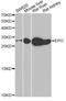 Erythropoietin antibody, A5663, ABclonal Technology, Western Blot image 
