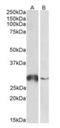 Glutathione S-transferase omega-1 antibody, orb233625, Biorbyt, Western Blot image 