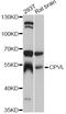 Probable serine carboxypeptidase CPVL antibody, abx125714, Abbexa, Western Blot image 