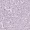 Trefoil Factor 1 antibody, HPA003425, Atlas Antibodies, Immunohistochemistry frozen image 