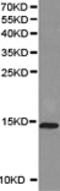 GTPase KRas antibody, TA322688, Origene, Western Blot image 