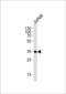 CD32a antibody, LS-C166101, Lifespan Biosciences, Western Blot image 