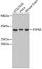 ECPTP antibody, 19-034, ProSci, Western Blot image 