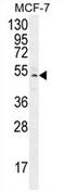 Zinc Finger Protein 829 antibody, AP54726PU-N, Origene, Western Blot image 