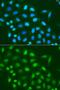 Histone Cluster 3 H3 antibody, GTX55659, GeneTex, Immunocytochemistry image 