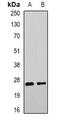 DnaJ Heat Shock Protein Family (Hsp40) Member B9 antibody, abx141994, Abbexa, Western Blot image 
