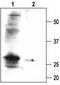 Potassium Calcium-Activated Channel Subfamily M Regulatory Beta Subunit 1 antibody, TA328943, Origene, Western Blot image 