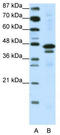 Cytosolic Iron-Sulfur Assembly Component 1 antibody, TA343487, Origene, Western Blot image 