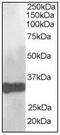 Claudin 14 antibody, AP08864PU-N, Origene, Western Blot image 