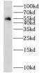 NOP2/Sun RNA Methyltransferase 6 antibody, FNab05872, FineTest, Western Blot image 