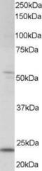 Max dimerization protein 4 antibody, GTX15841, GeneTex, Western Blot image 
