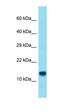 CFAP97 Domain Containing 1 antibody, orb326894, Biorbyt, Western Blot image 