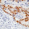 p53 antibody, LS-C87893, Lifespan Biosciences, Immunohistochemistry frozen image 