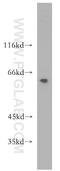 Male Germ Cell Associated Kinase antibody, 13638-1-AP, Proteintech Group, Western Blot image 