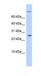 AT-Rich Interaction Domain 5A antibody, orb325674, Biorbyt, Western Blot image 