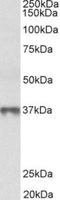 Methionine adenosyltransferase 2 subunit beta antibody, TA311407, Origene, Western Blot image 