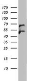 3-Oxoacyl-ACP Synthase, Mitochondrial antibody, MA5-26529, Invitrogen Antibodies, Western Blot image 