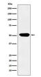 Cytochrome P450 Family 4 Subfamily A Member 11 antibody, M03493, Boster Biological Technology, Western Blot image 