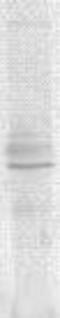Arachidonate 15-Lipoxygenase Type B antibody, TA354514, Origene, Western Blot image 