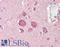 SMG6 Nonsense Mediated MRNA Decay Factor antibody, LS-B15630, Lifespan Biosciences, Immunohistochemistry paraffin image 