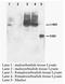 Patatin Like Phospholipase Domain Containing 6 antibody, AP23385PU-N, Origene, Western Blot image 