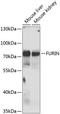 Furin, Paired Basic Amino Acid Cleaving Enzyme antibody, A01344, Boster Biological Technology, Western Blot image 
