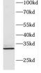 Chromosome X Open Reading Frame 56 antibody, FNab02111, FineTest, Western Blot image 
