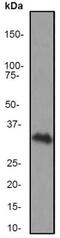 CD8 antibody, ab93278, Abcam, Western Blot image 