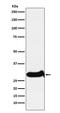 Insulin Like Growth Factor Binding Protein 7 antibody, M02410, Boster Biological Technology, Western Blot image 