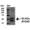Cysteine protease ATG4D antibody, PA5-77781, Invitrogen Antibodies, Western Blot image 