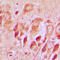 Synuclein Alpha Interacting Protein antibody, LS-C353186, Lifespan Biosciences, Immunohistochemistry paraffin image 