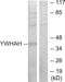 Tyrosine 3-Monooxygenase/Tryptophan 5-Monooxygenase Activation Protein Eta antibody, abx013880, Abbexa, Western Blot image 