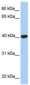 GA Binding Protein Transcription Factor Subunit Beta 1 antibody, TA339795, Origene, Western Blot image 