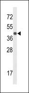 Centromere protein K antibody, LS-B9423, Lifespan Biosciences, Western Blot image 