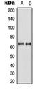 P21 (RAC1) Activated Kinase 3 antibody, orb315644, Biorbyt, Western Blot image 
